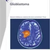 Glioblastoma: New Molecular Concepts Pave the Way for Advances in Diagnosis and Treatment. (Fast Facts) (EPUB)