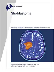 Glioblastoma: New Molecular Concepts Pave the Way for Advances in Diagnosis and Treatment. (Fast Facts) (EPUB)
