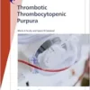 Fast Facts: Thrombotic Thrombocytopenic Purpura (EPUB)