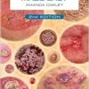 Dermatology Made Easy, 2nd edition (PDF) Dermatology Made Easy, 2nd edition (PDF)