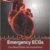 Emergency ECGs: Case-Based Review and Interpretations (EPUB)