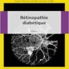 Rétinopathie diabétique, 3rd Edition (EPUB)