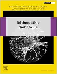 Rétinopathie diabétique, 3rd Edition (EPUB)