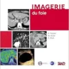 Imagerie du foie (PDF)