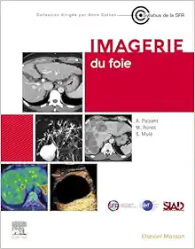 Imagerie du foie (PDF)