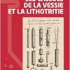 Les calculs de la vessie et la lithotritie (French Edition) (EPUB)