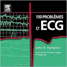150 problèmes d’ECG (PDF)