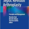One-Stage Septic Revision Arthroplasty: Principles and Management (EPUB) One-Stage Septic Revision Arthroplasty: Principles and Management (EPUB)