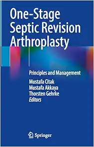 One-Stage Septic Revision Arthroplasty: Principles and Management (EPUB) One-Stage Septic Revision Arthroplasty: Principles and Management (EPUB)