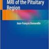 Tricks and Traps in MRI of the Pituitary Region (PDF)