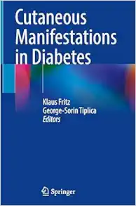 Cutaneous Manifestations in Diabetes (PDF)