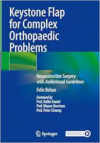 Keystone Flap for Complex Orthopaedic Problems: Reconstructive Surgery with Audiovisual Guidelines (PDF ) Keystone Flap for Complex Orthopaedic Problems: Reconstructive Surgery with Audiovisual Guidelines (PDF )