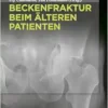 Beckenfraktur beim älteren Patienten (German Edition) (EPUB)