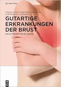 Gutartige Erkrankungen der Brust: Ein Leitfaden für die Praxis (German Edition) (EPUB)