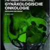 Gynäkologische Onkologie: für Klinik und Praxis, 2nd Edition (German Edition) (PDF)