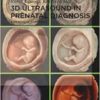 3D Ultrasound in Prenatal Diagnosis: A Practical Approach, 2nd Edition (PDF)