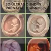 3D Ultrasound in Prenatal Diagnosis: A Practical Approach (EPUB)
