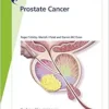 Prostate Cancer (Fast Facts), 10th Edition (EPUB)
