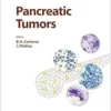 Pancreatic Tumors (Monographs in Clinical Cytology) (EPUB)