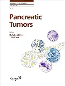 Pancreatic Tumors (Monographs in Clinical Cytology) (EPUB)