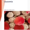 Fast Facts: Leucemia (Spanish Edition) (PDF )
