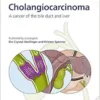 Fast Facts for Patients and Supporters: Cholangiocarcinoma (PDF )