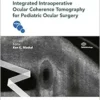 Integrated Intraoperative Ocular Coherence Tomography for Pediatric Ocular Surgery (EPUB)