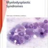 Fast Facts: Myelodysplastic Syndromes (EPUB)