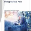 Fast Facts: Perioperative Pain (EPUB)