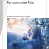 Fast Facts: Perioperative Pain (PDF )