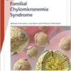 Fast Facts: Familial Chylomicronemia Syndrome (EPUB)