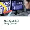 Fast Facts: Non-Small-Cell Lung Cancer, 2nd Edition (EPUB)