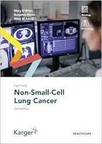 Fast Facts: Non-Small-Cell Lung Cancer, 2nd Edition (EPUB)