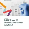 Fast Facts: EGFR Exon 20 Insertion Mutations in NSCLC (EPUB) Fast Facts: EGFR Exon 20 Insertion Mutations in NSCLC (EPUB)