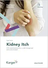 Fast Facts: Kidney Itch (EPUB)