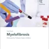 Fast Facts: Myelofibrosis (PDF )