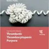 Fast Facts for Patients: Thrombotic Thrombocytopenic Purpura: Prompt action saves lives (PDF )