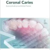 Coronal Caries (Monographs In Oral Science, 31) (PDF )