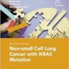 Non-small Cell Lung Cancer With Kras Mutation (Fast Facts for Patients) (EPUB)
