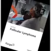 Fast Facts: Follicular Lymphoma (PDF)