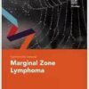 Fast Facts for Patients: Marginal Zone Lymphoma (EPUB)