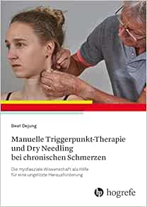 Manuelle Triggerpunkt-Therapie und Dry Needling bei chronischen Schmerzen (PDF)