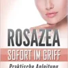 Rosazea sofort im Griff: Praktische Anleitung (German Edition) (EPUB) Rosazea sofort im Griff: Praktische Anleitung (German Edition) (EPUB)
