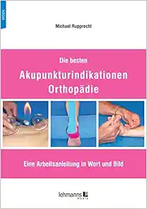 Die besten Akupunkturindikationen Orthopädie (PDF)