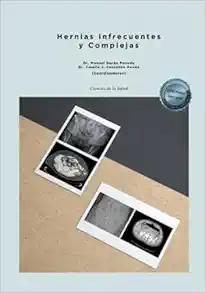 Hernias Infrecuentes y Complejas (PDF)