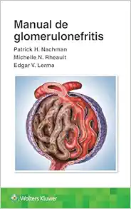 Manual de glomerulonefritis (Spanish Edition) (EPUB) Manual de glomerulonefritis (Spanish Edition) (EPUB)