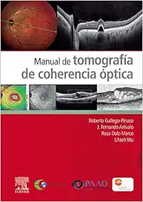 Manual de tomografía de coherencia óptica (PDF) Manual de tomografía de coherencia óptica (PDF)