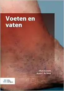 Voeten en vaten (Dutch Edition) (EPUB)
