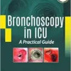 Bronchoscopy in ICU: A Practical Guide (PDF)