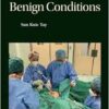 Hysterectomy For Benign Conditions (EPUB)
